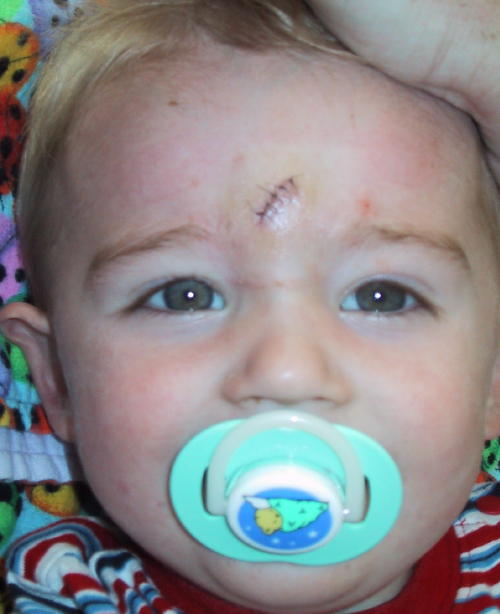 Jun 05 Stitches 2.jpg